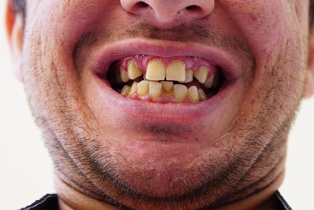 Invisalign og det praktiske forløb fra overvejelse til vedligeholdelse